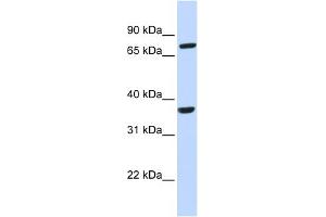 WB Suggested Anti-CCRL2 Antibody Titration:  0.