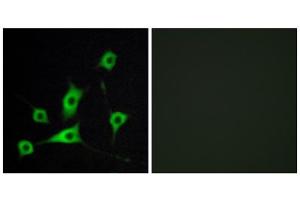 Immunofluorescence analysis of LOVO cells, using CRBP III antibody. (Retinol Binding Protein 5 Antikörper  (N-Term))