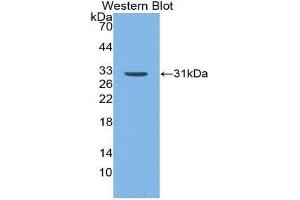 Western Blotting (WB) image for anti-CD109 (CD109) (AA 1146-1390) antibody (ABIN1867106) (CD109 Antikörper  (AA 1146-1390))