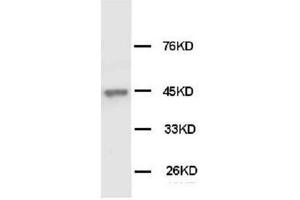 Western Blotting (WB) image for anti-Keratin 18 (KRT18) antibody (ABIN1106917) (Cytokeratin 18 Antikörper)