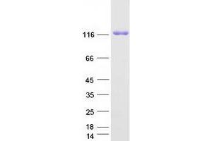 Western Blotting (WB) image for EPH Receptor A2 (EPHA2) protein (Myc-DYKDDDDK Tag) (ABIN2720231)