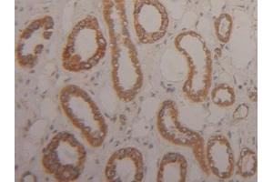 Immunohistochemistry (IHC) image for anti-Arginase, Type II (ARG2) (AA 23-354) antibody (ABIN7435613)