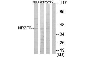 Western Blotting (WB) image for anti-Nuclear Receptor Subfamily 2, Group F, Member 6 (NR2F6) (N-Term) antibody (ABIN1849146) (NR2F6 Antikörper  (N-Term))