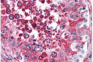 Human Testis (formalin-fixed, paraffin-embedded) stained with RTN4 antibody ABIN343914 at 3 ug/ml followed by biotinylated goat anti-rabbit IgG secondary antibody ABIN481713, alkaline phosphatase-streptavidin and chromogen. (Reticulon 4 Antikörper  (N-Term))