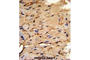 Immunohistochemistry (IHC) image for anti-phosphoprotein Enriched in Astrocytes 15 (PEA15) antibody (ABIN3003786)