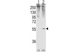Western Blotting (WB) image for anti-Growth Differentiation Factor 11 (GDF11) (AA 32-61) antibody (ABIN3031109)