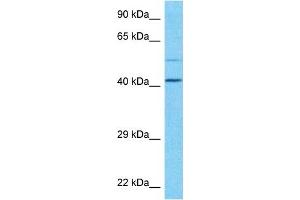 Host:  Rabbit  Target Name:  PLD3  Sample Type:  U937 Whole Cell lysates  Antibody Dilution:  1. (PLD3 Antikörper  (N-Term))