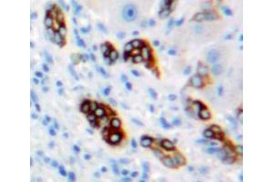 Used in DAB staining on fromalin fixed paraffin-embedded liver tissue (CA9 Antikörper  (AA 59-414))