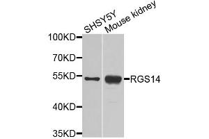 Western blot analysis of extracts of various cell lines, using RGS14 antibody. (RGS14 Antikörper)