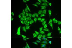 Immunofluorescence analysis of A549 cells using IREB2 Polyclonal Antibody (IREB2 Antikörper)