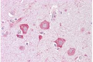 Anti-KCNQ2 antibody IHC staining of human brain, cortex.