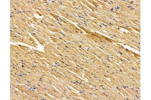 ABIN7096063 and ABIN7100125 at 1/100 staining rat muscle tissue by IHC-P. (SCUBE1 Antikörper)