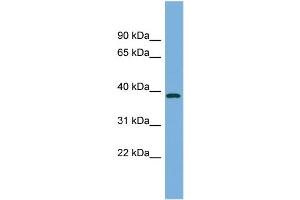 WB Suggested Anti-FBP2 Antibody Titration:  0.
