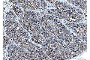 IHC analysis of Poliovirus Receptor/PVR using anti-Poliovirus Receptor/PVR antibody (ABIN7601072). (Poliovirus Receptor Antikörper  (AA 28-331))