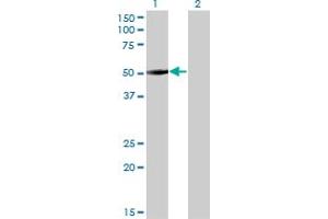 Western Blot analysis of ZNF213 expression in transfected 293T cell line by ZNF213 monoclonal antibody (M01), clone 5D7. (ZNF213 Antikörper  (AA 133-242))