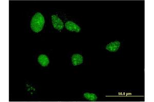Immunofluorescence (IF) image for anti-LIM Domains Containing 1 (LIMD1) (AA 577-674) antibody (ABIN522438)