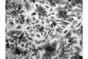 Imunohistochemical analysis of rat brain astrocyte, using Slc22a3 polyclonal antibody  . (SLC22A3 Antikörper)