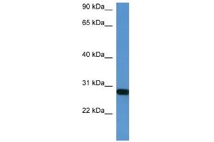 WB Suggested Anti-Hoxb1 Antibody Titration:  0. (HOXB1 Antikörper  (C-Term))