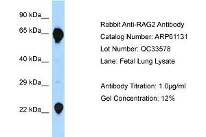Western Blotting (WB) image for anti-Recombination Activating Gene 2 (RAG2) (C-Term) antibody (ABIN2788687) (RAG2 Antikörper  (C-Term))