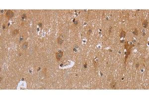 Immunohistochemistry of paraffin-embedded Human brain using GABPB2 Polyclonal Antibody at dilution of 1:30 (GABPB2 Antikörper)