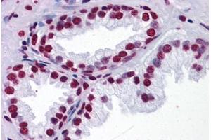 Human Prostate: Formalin-Fixed, Paraffin-Embedded (FFPE) (THOC6 Antikörper  (AA 71-181))