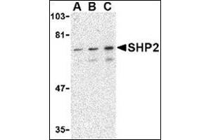 Western blot analysis of SHP2 in mouse skeletal muscle tissue lysate with this product at (A) 0.