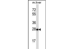 HELT Antibody (Center) (ABIN657547 and ABIN2846562) western blot analysis in mouse liver tissue lysates (35 μg/lane).