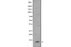 Western blot analysis of extracts from HeLa cells, using TUSC2 antibody. (TUSC2 Antikörper  (Internal Region))