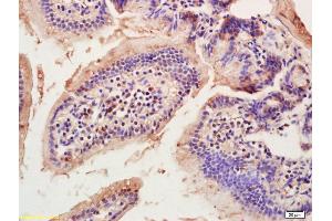 Formalin-fixed and paraffin embedded mouse intestine labeled with Anti-SCP2/NLTP Polyclonal Antibody, Unconjugated (ABIN676688) at 1:200, followed by conjugation to the secondary antibody and DAB staining (SCP2 Antikörper  (AA 451-547))