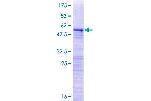 Image no. 1 for Retinitis Pigmentosa 9 (Autosomal Dominant) (RP9) (AA 1-221) protein (GST tag) (ABIN1318496) (RP9 Protein (AA 1-221) (GST tag))