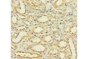 Immunohistochemistry of paraffin-embedded human kidney tissue using ABIN7170187 at dilution of 1:100 (SLC25A35 Antikörper  (AA 120-168))