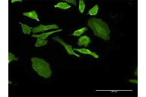 Immunofluorescence of monoclonal antibody to DHRS9 on HeLa cell.