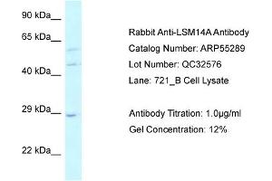 WB Suggested Anti-LSM14A Antibody Titration: 0.