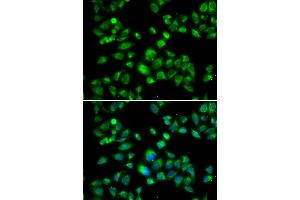 Immunofluorescence analysis of U2OS cells using MBTPS1 antibody. (MBTPS1 Antikörper)