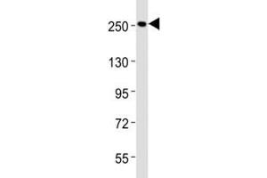 Western Blotting (WB) image for anti-Nestin (NES) (AA 1389-1416) antibody (ABIN3031961)