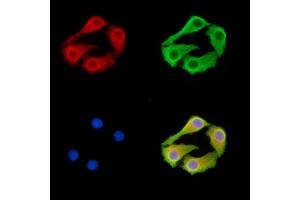 anti-Inhibin Binding Protein (INHBP) antibody