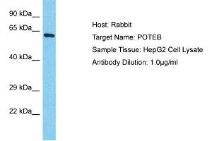 Host: Rabbit Target Name: POTEB Sample Type: HepG2 Whole Cell lysates Antibody Dilution: 1. (POTEB Antikörper  (C-Term))