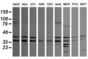Image no. 1 for anti-Mitogen-Activated Protein Kinase 9 (MAPK9) antibody (ABIN1498930) (JNK2 Antikörper)