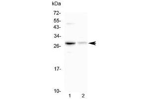 Western blot testing of 1) mouse HEPA1-6 and 2) rat kidney lysate with Oncostatin M antibody at 0. (Oncostatin M Antikörper)