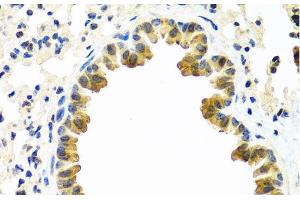 Immunohistochemistry of paraffin-embedded Mouse lung using CRTAP Polyclonal Antibody at dilution of 1:100 (40x lens). (CRTAP Antikörper)