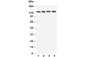 Western blot testing of TLR7 antibody and Lane 1:  rat spleen (TLR7 Antikörper  (C-Term))