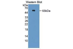 Western blot analysis of recombinant Human Kim1. (HAVCR1 Antikörper  (AA 21-245))