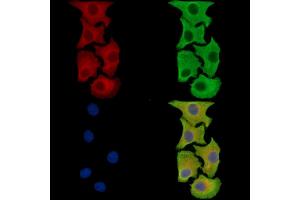 ABIN7095953 and ABIN7100015 staining Hela cells by IF/ICC.