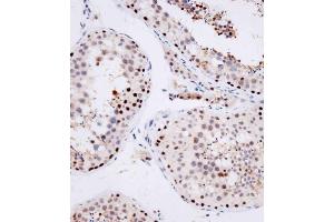 Immunohistochemical analysis of (ABIN1539554 and ABIN2849696) on paraffin-embedded human testis tissue was performed on the Leica®BOND RXm. (OTUD7A Antikörper  (N-Term))