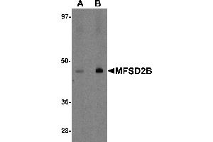 Western blot analysis of MFSD2B in rat lung tissue lysate with MFSD2B antibody at (A) 1 and (B) 2 µg/mL. (MFSD2B Antikörper  (Middle Region))
