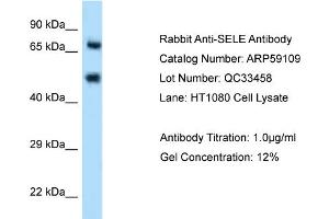 WB Suggested Anti-SELE Antibody Titration: 0. (Selectin E/CD62e Antikörper  (N-Term))