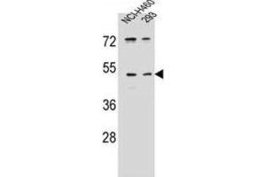 Western Blotting (WB) image for anti-Protease, Serine, 55 (PRSS55) antibody (ABIN2996346) (PRSS55 Antikörper)