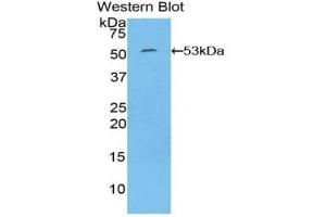 Detection of Recombinant IL6, Human using Polyclonal Antibody to Interleukin 6 (IL6) (IL-6 Antikörper  (AA 29-212))