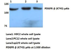Western blot (WB) analyzes of PDGFR-β antibody (PDGFRB Antikörper)
