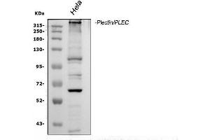 Western blot analysis of Plectin using anti-Plectin antibody (ABIN3043900). (PLEC Antikörper  (Middle Region))